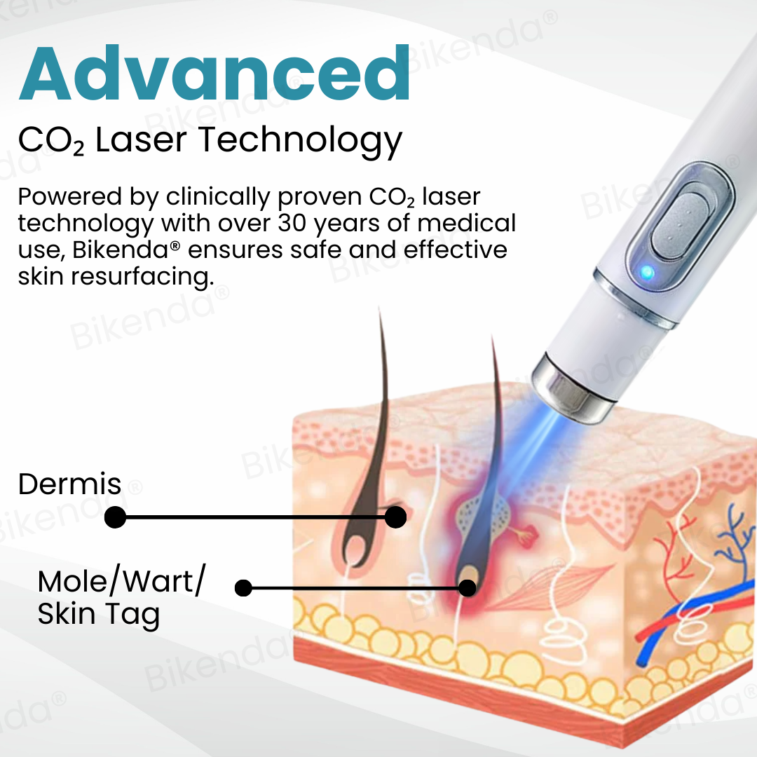 Bikenda® Non-invasive Mole and Wart Removal Laser Pen