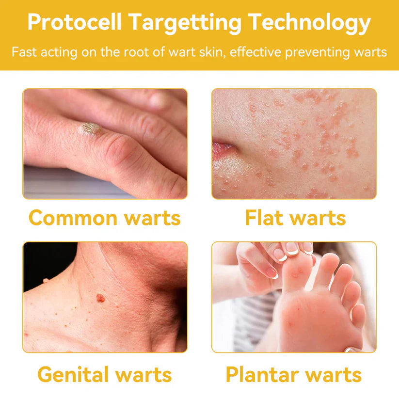 🔥FDA Approved⭐ WHO Approved🌍 Cvreoz® Bee Venom Skin Treatment Cream - Fast and effective⚡ targeting all skin issues✅ If ineffective, a refund is guaranteed💯