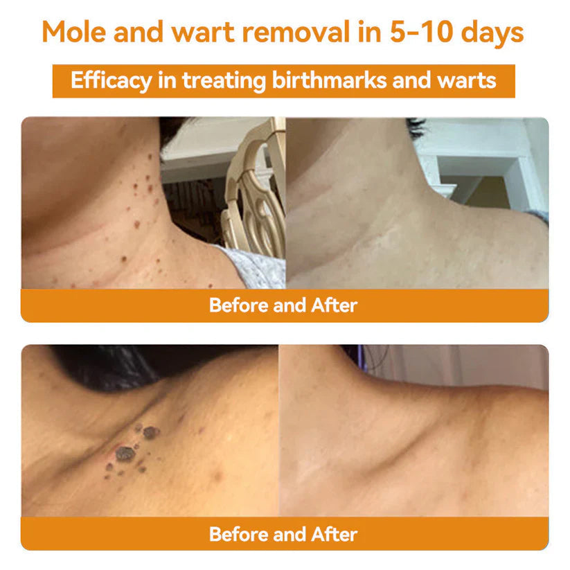 🔥FDA Approved⭐ WHO Approved🌍 Cvreoz® Bee Venom Skin Treatment Cream - Fast and effective⚡ targeting all skin issues✅ If ineffective, a refund is guaranteed💯