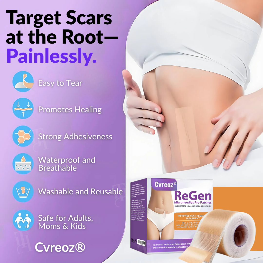 Official Store: Cvreoz® ReGen Microneedles Pro Patches with Hyaluronic Acid Nano-Heal Treatment for new and old scars, reduction of surgical scars, stretch marks, keloids, acne, burns, warts, dermatomas, and varicose veins.