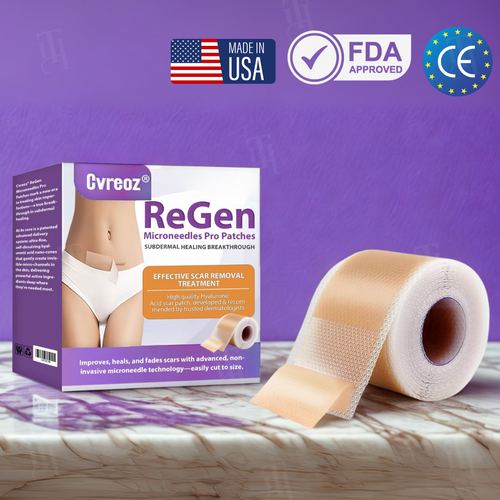 Official Store: Cvreoz® ReGen Microneedles Pro Patches with Hyaluronic Acid Nano-Heal Treatment for new and old scars, reduction of surgical scars, stretch marks, keloids, acne, burns, warts, dermatomas, and varicose veins.