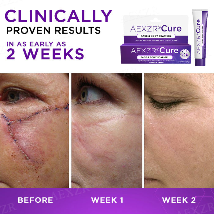 🔥FDA Approved⭐ WHO Approved🌍 AEXZR® Cure Face & Body Scar Gel – Clinically proven to soften, flatten and fade surgical scars, acne marks, burns, keloids and trauma-related scars.