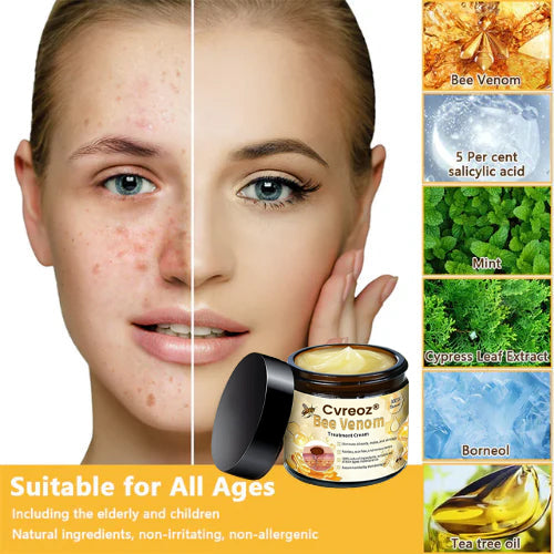 🔥FDA Approved⭐ WHO Approved🌍 Cvreoz® Bee Venom Skin Treatment Cream - Fast and effective⚡ targeting all skin issues✅ If ineffective, a refund is guaranteed💯