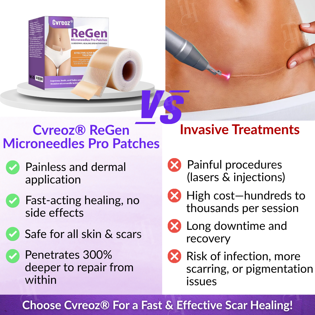 Official Store: Cvreoz® ReGen Microneedles Pro Patches with Hyaluronic Acid Nano-Heal Treatment for new and old scars, reduction of surgical scars, stretch marks, keloids, acne, burns, warts, dermatomas, and varicose veins.