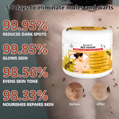 BeeVeno™ Bee Venom Mole and Wart Treatment Cream (👨‍⚕AAD RECOMMENDS)