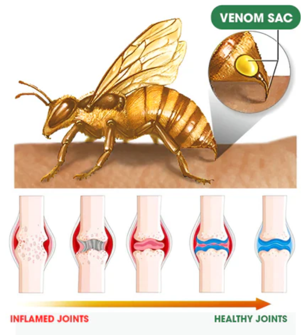 Beethera™ Bee Venom Advanced Joint and Bone Therapy Cream (New Zealand Bee Extract - Specializes in Orthopedic Diseases and Arthritis Pain)