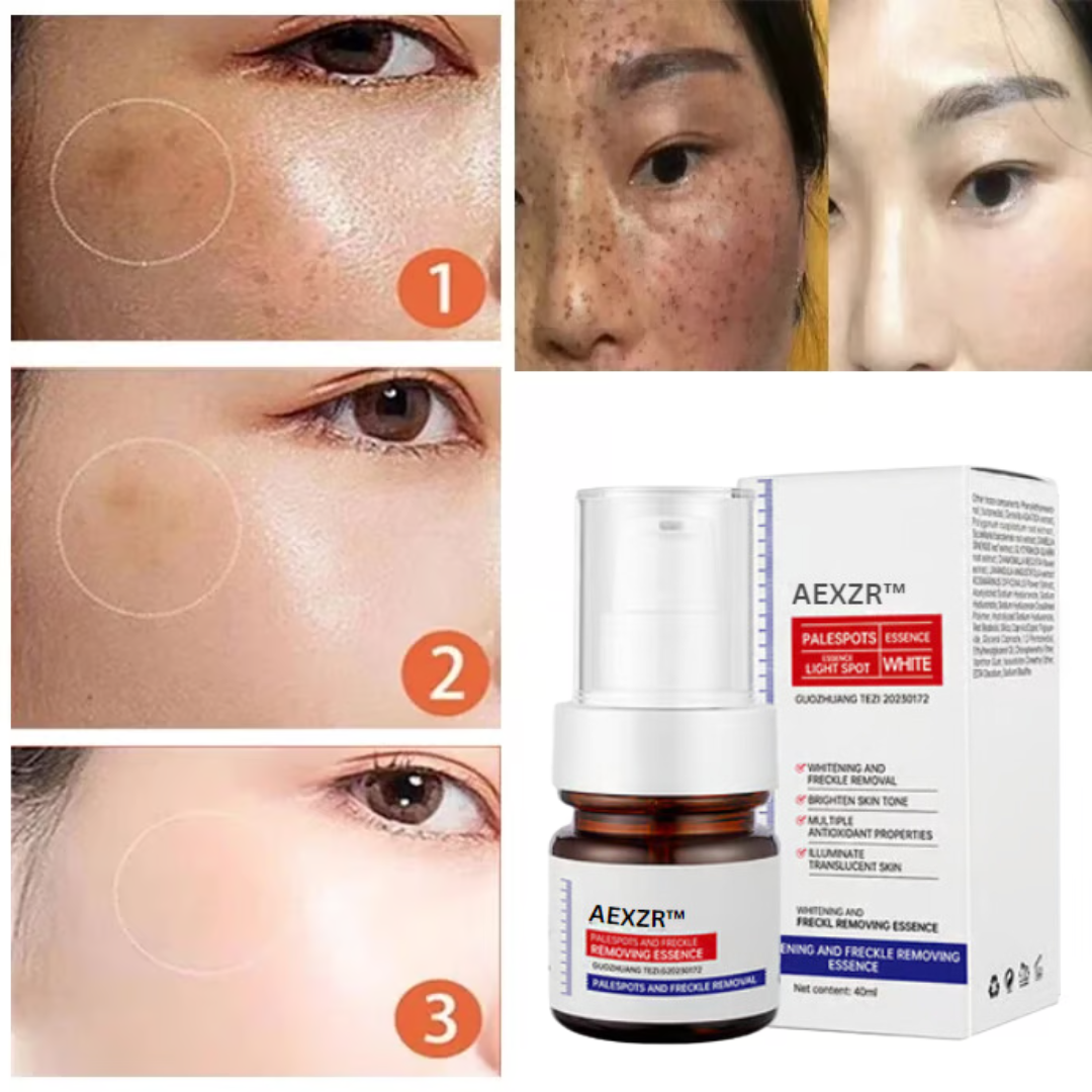 🔥 AEXZR™ Vitamin C Whitening Freckles Face Cream Remove Melasma Dark Spots Lighten Melanin