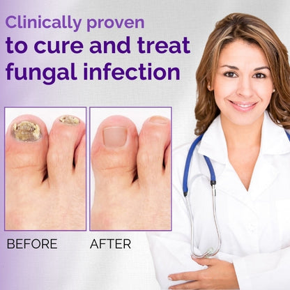 AEXZR™ Nail Fungal Essence