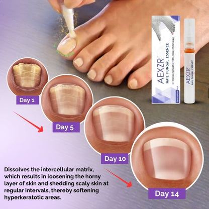 AEXZR™ Nail Fungal Essence