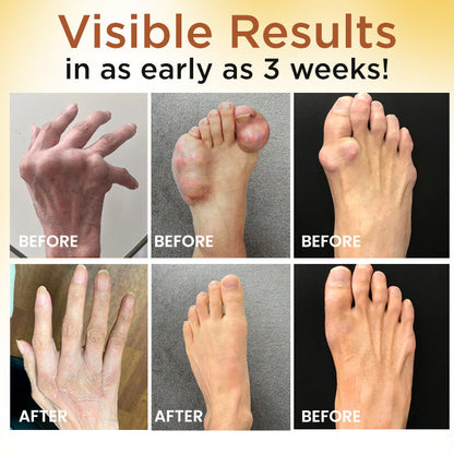 🔥FDA Approved⭐ WHO Approved🌍 Croaie® Bee Venom Pain-Relief Joint Soothing Spray - No allergies🌸 quick and effective⚡️ The first 200 customers will receive double the order🎁!