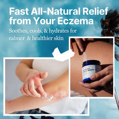 The Ocean Healed  Eczema Soothing Cream