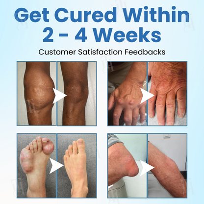 🔥FDA Approved⭐ WHO Approved🌍 Croaie® EnduraHeal Magnesium Pain Relief Cream - Treats Arthritis, Neuropathy Rheumatism, Sports Injuries & More✅