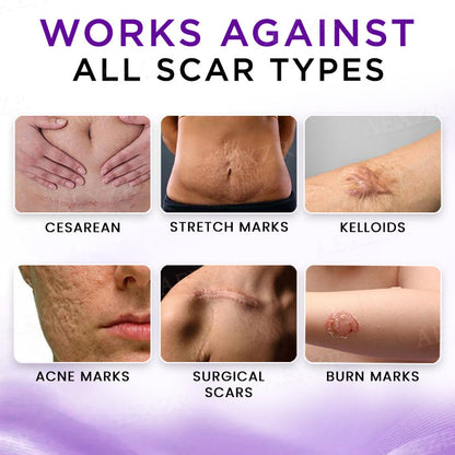 🔥FDA Approved⭐ WHO Approved🌍 AEXZR® Cure Face & Body Scar Gel – Clinically proven to soften, flatten and fade surgical scars, acne marks, burns, keloids and trauma-related scars.