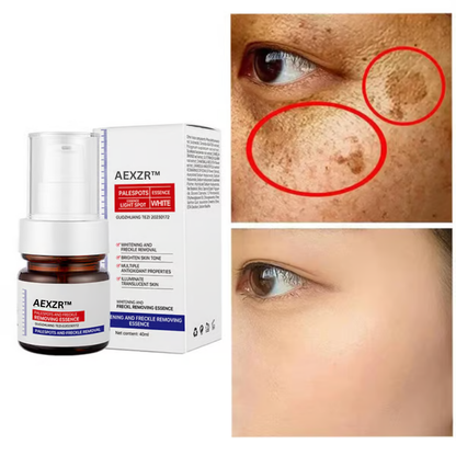 🔥 AEXZR™ Vitamin C Whitening Freckles Face Cream Remove Melasma Dark Spots Lighten Melanin