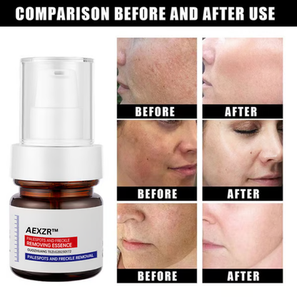 🔥 AEXZR™ Vitamin C Whitening Freckles Face Cream Remove Melasma Dark Spots Lighten Melanin