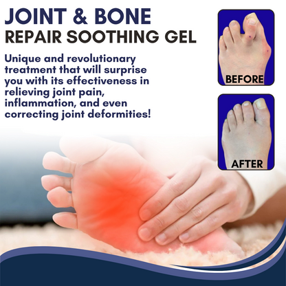 AEXZR™ Joint & Bone Repair Gel Roller