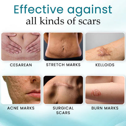 AEXZR™ Advance Scar Care Formula