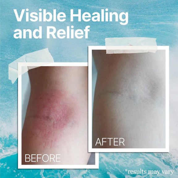 The Ocean Healed  Eczema Soothing Cream