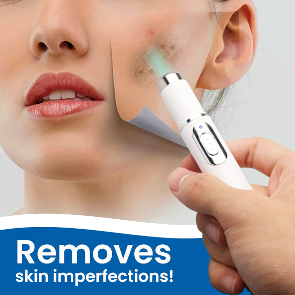 Osmios™ Blue Light Skin Spot Remover