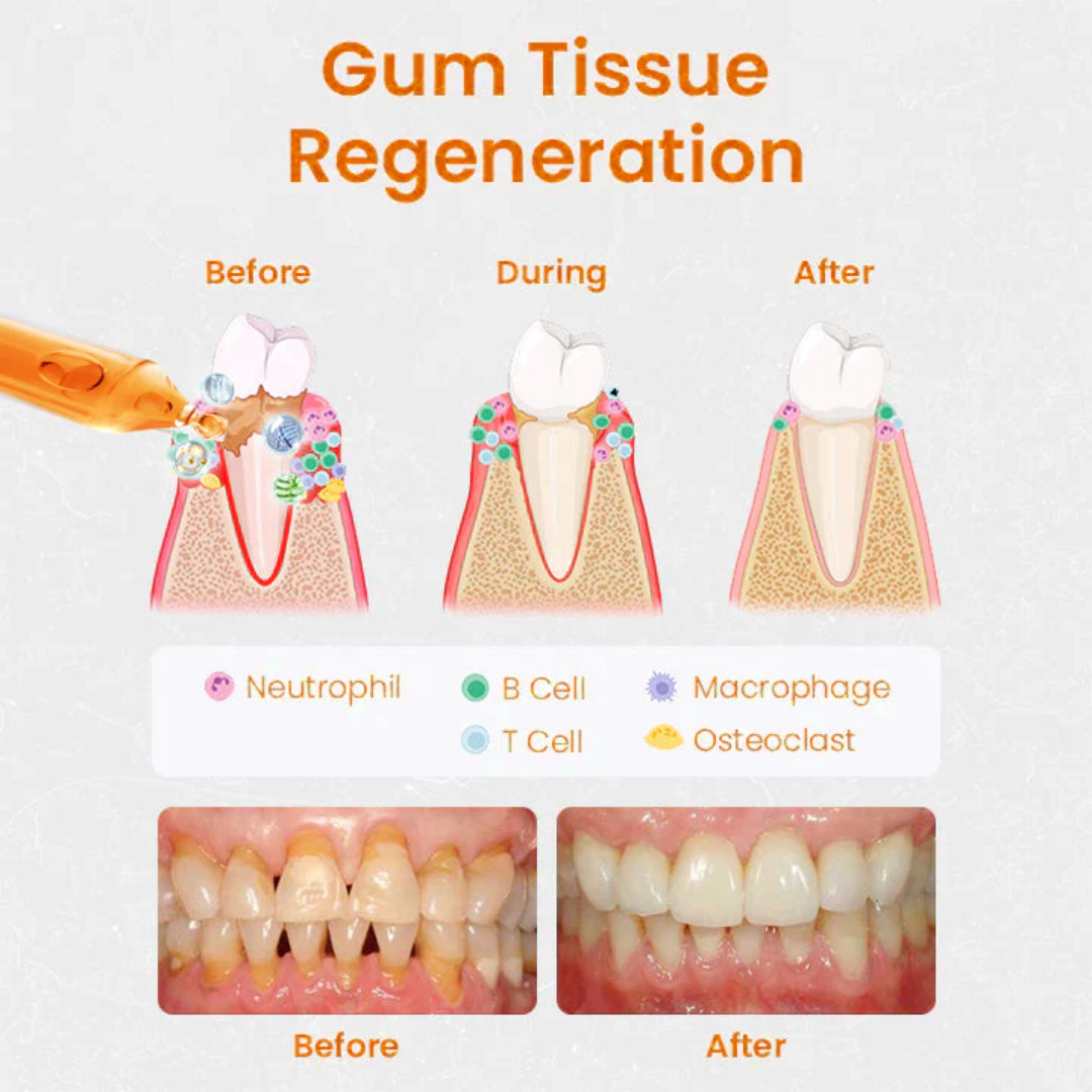 AEXZR™ Gum Repair Treatment Ampoules