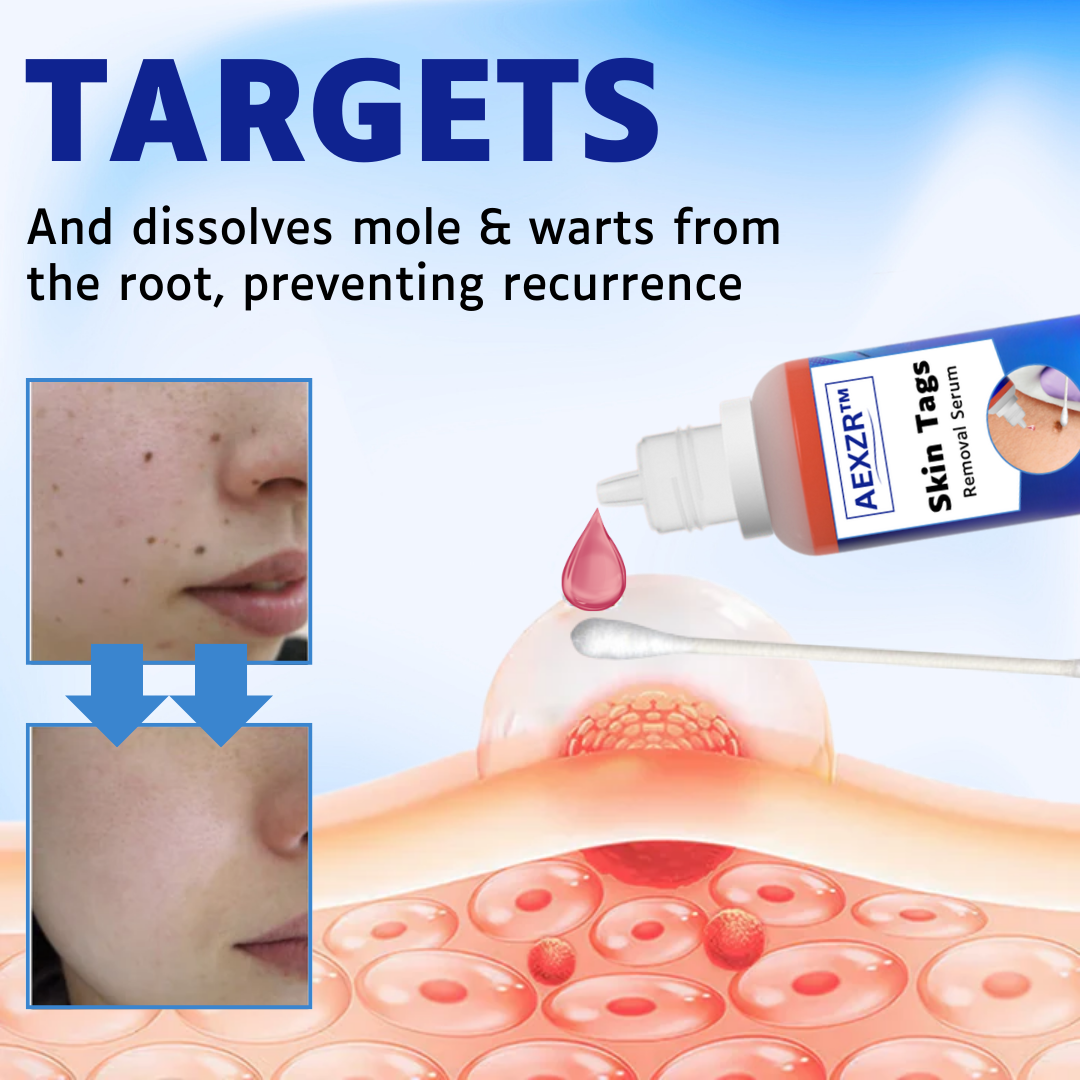 AEXZR™ Skin Tags Removal Serum