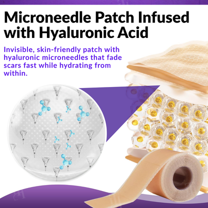 Official Store: Cvreoz® ReGen Microneedles Pro Patches with Hyaluronic Acid Nano-Heal Treatment for new and old scars, reduction of surgical scars, stretch marks, keloids, acne, burns, warts, dermatomas, and varicose veins.