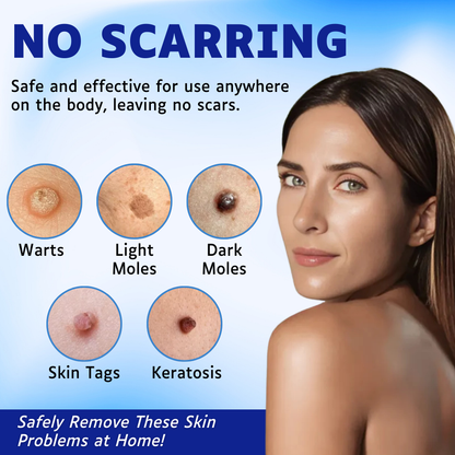 AEXZR™ Skin Tags Removal Serum