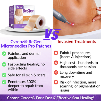 Official Store: Cvreoz® ReGen Microneedles Pro Patches with Hyaluronic Acid Nano-Heal Treatment for new and old scars, reduction of surgical scars, stretch marks, keloids, acne, burns, warts, dermatomas, and varicose veins.