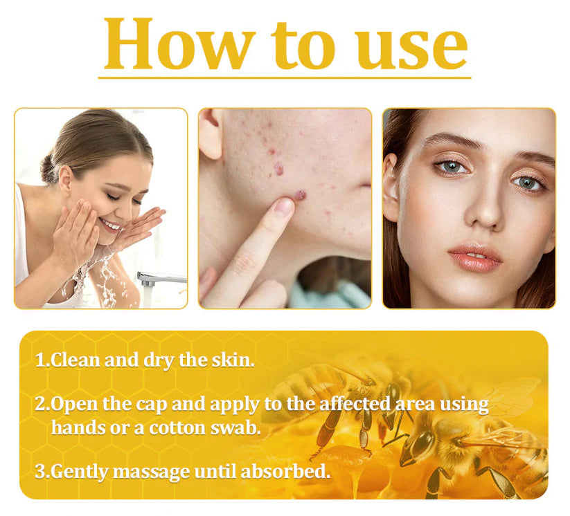 🔥FDA Approved⭐ WHO Approved🌍 Cvreoz® Bee Venom Skin Treatment Cream - Fast and effective⚡ targeting all skin issues✅ If ineffective, a refund is guaranteed💯