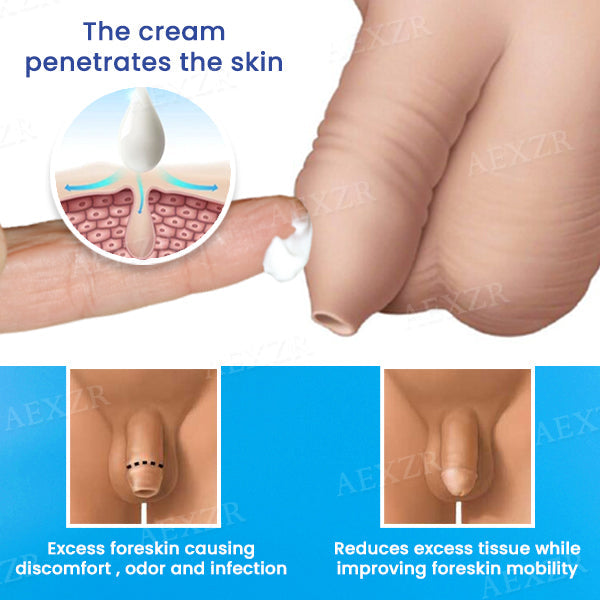 AEXZR™ Foreskin Cream Solution