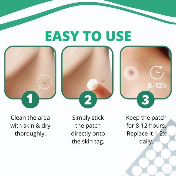 AEXZR™ Skin Tag Remover Patch