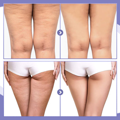 SKINNIER Anticellulite & Tightening Thigh Patch