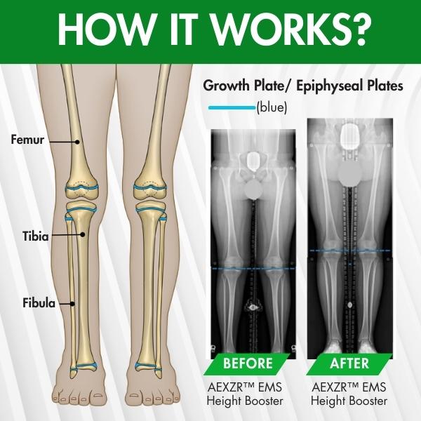 AEXZR™ EMS Height Booster