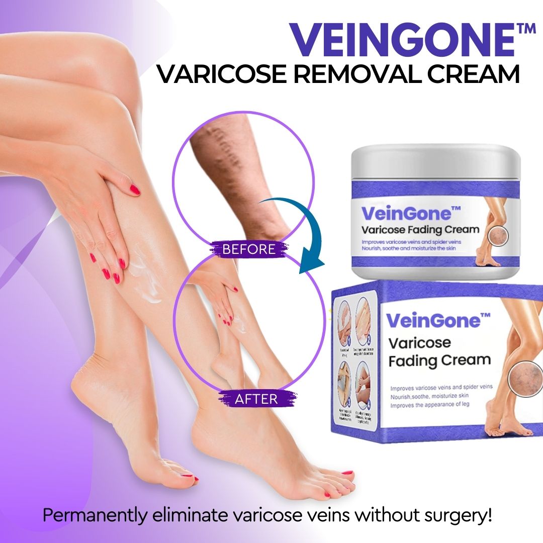 VeinGone™ Varicose Fading Cream