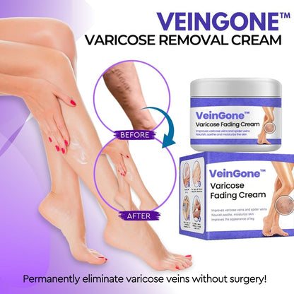 VeinGone™ Varicose Fading Cream