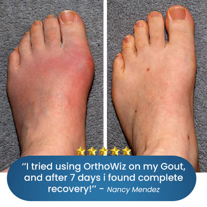 OrthoWiz™ Bone & Joint Pain Therapy Foot Brace