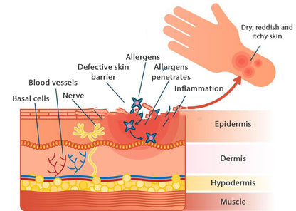 AEXZR™ Folliculitis Clearing Spray