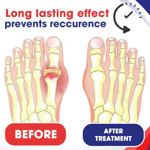 AEXZR™ Therapeutic Gout Gel